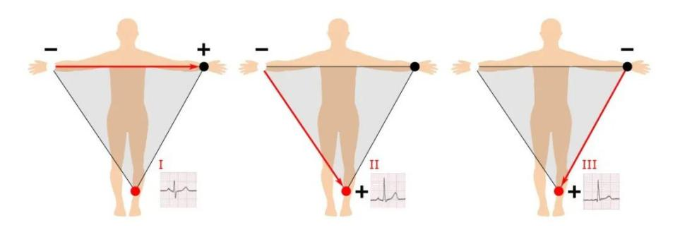 ecg1.png