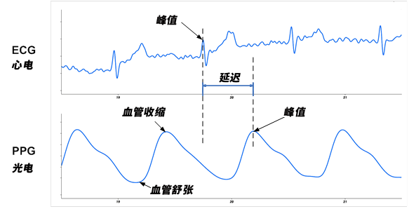 ecg2.png